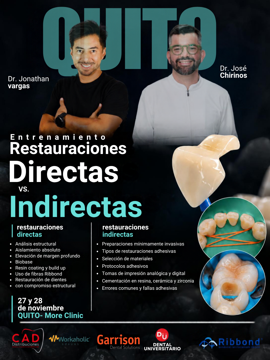Afiche: Restauraciones Directas vs. Indirectas en Quito
